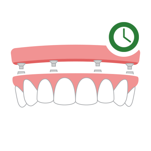 ALL-ON-4 DENTAL IMPLANTS